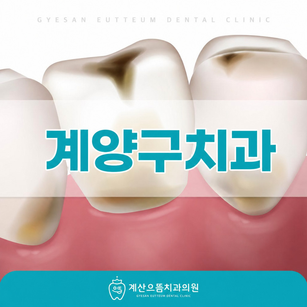 계양구치과 충치치료 초기 확인이 깊어지기 전 필요한 이유와 달라지는 일상 변화