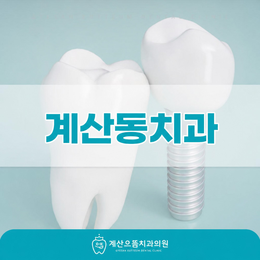 계산동치과 임플란트 오래 쓰는 방법과 처음 계획부터 이후 관리까지 확인 사항