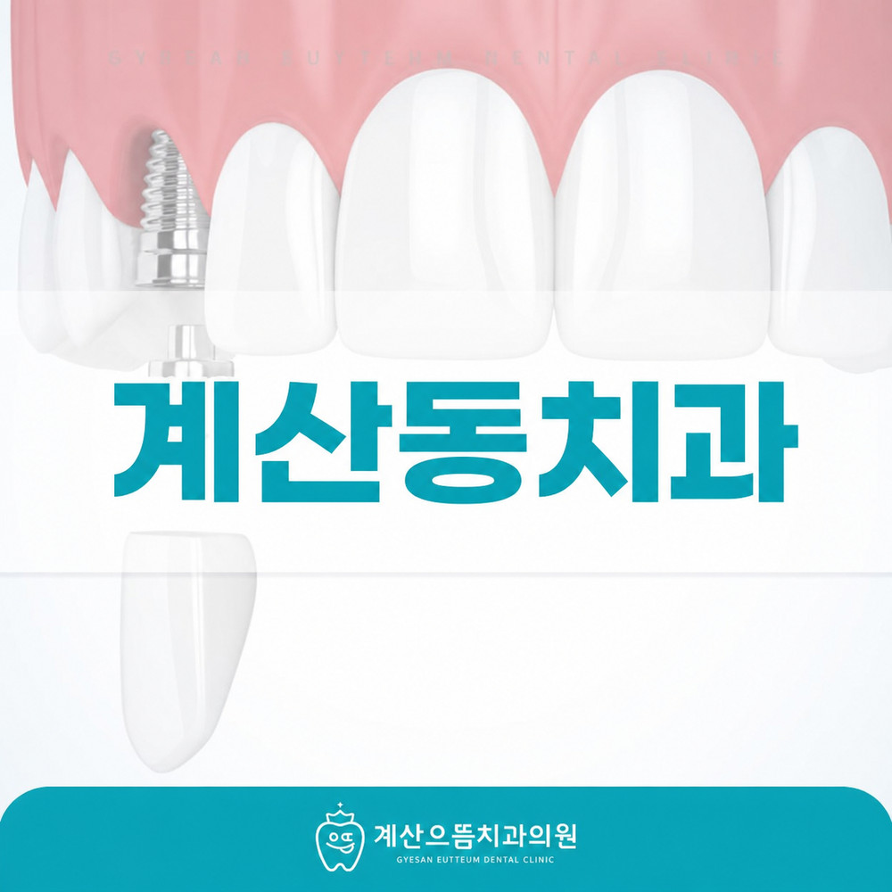 계산동치과 치아 상실 후 임플란트로 자연치아 기능 대체하는 치료 방법 확인