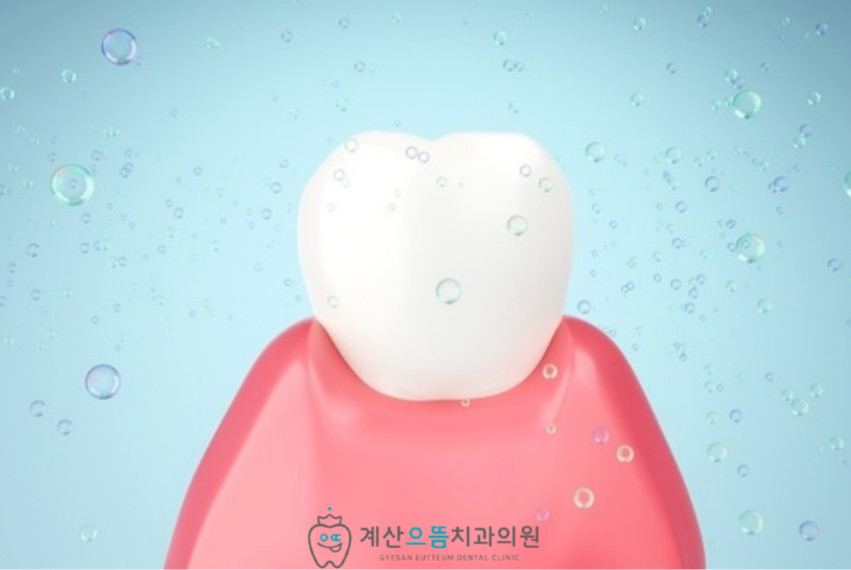 계산동치과 잇몸병 초기 통증 없이 잇몸과 잇몸뼈 염증이 진행되는 주의사항