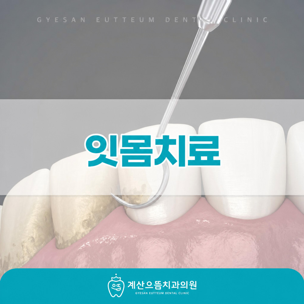 양치 후에도 남는 치석과 잇몸치료 전 정기 스케일링 관리 필요성 확인