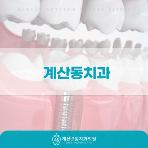 gyesan-dong-dental-implant-1