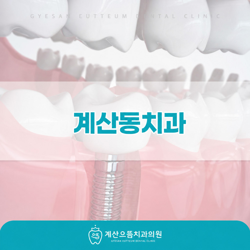 계산동치과 임플란트 수명 좌우 생활 습관과 관리법 확인 전 기본 정보