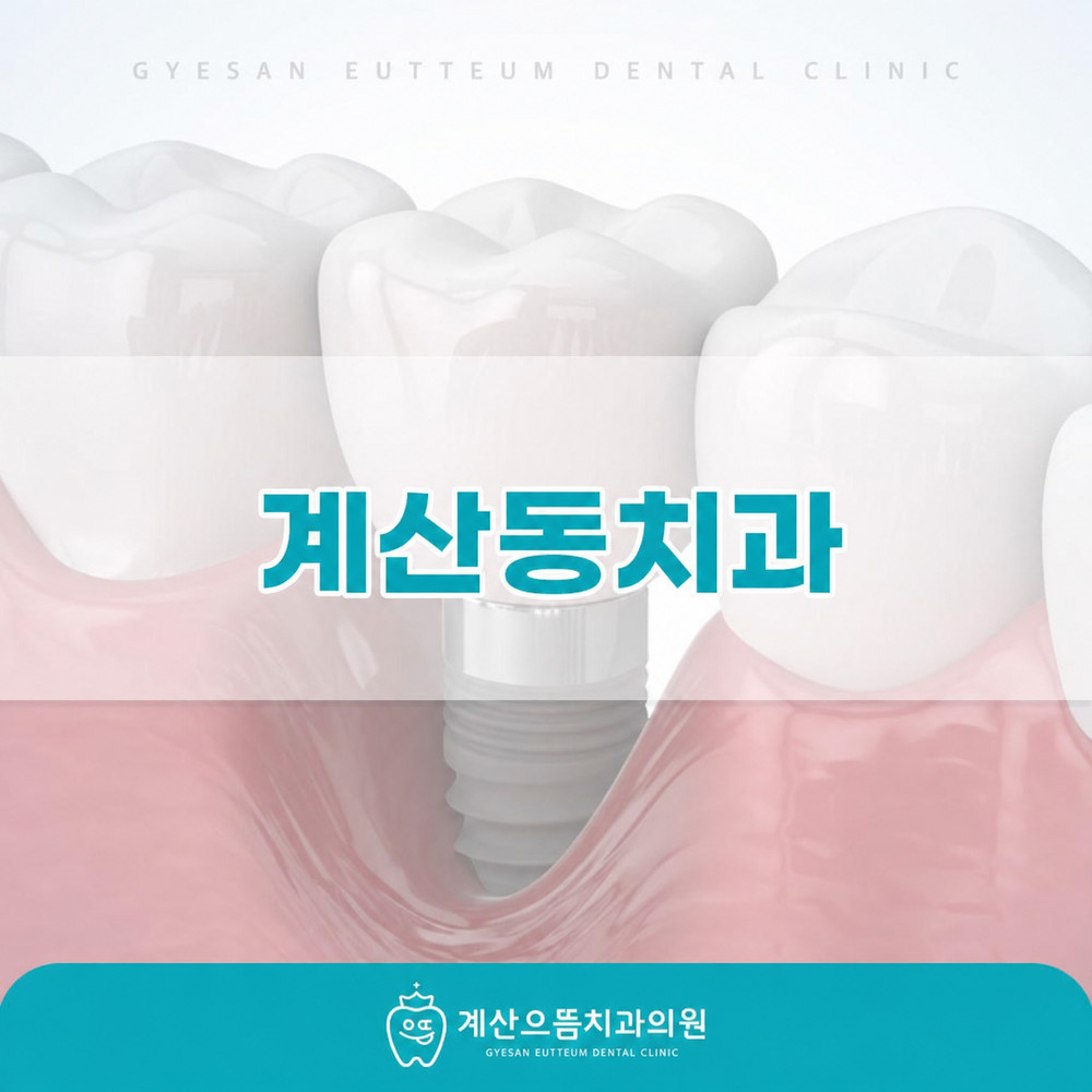 계산동치과 임플란트 선택 후 일상생활 편안함과 사용 기간 관리 중요성 확인