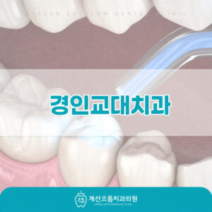 gyeongin-gyodae-resin-discoloration-1